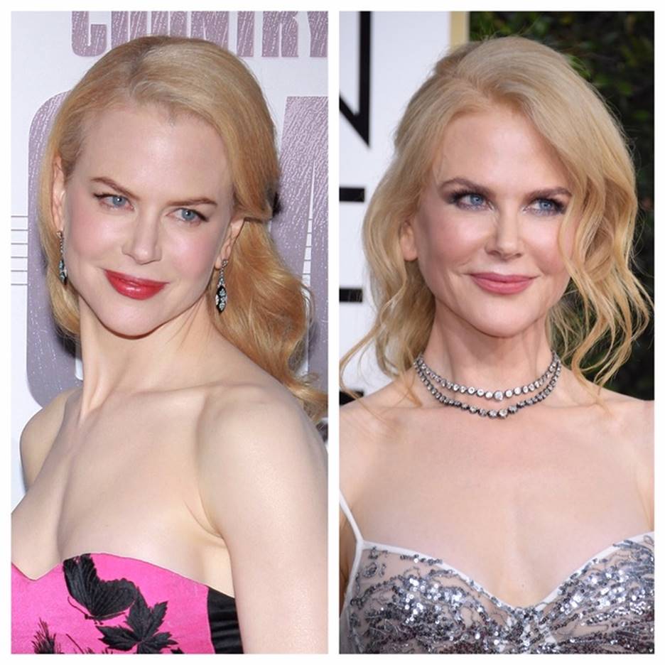 Nicole Kidman Before and After